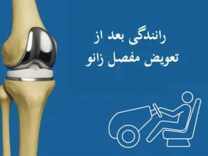 رانندگی بعد از تعویض مفصل زانو