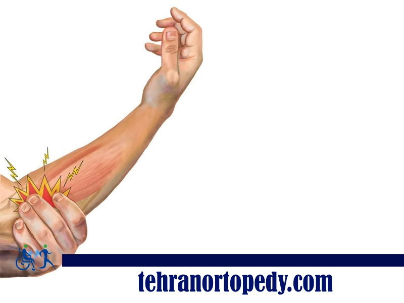 علل درد آرنج