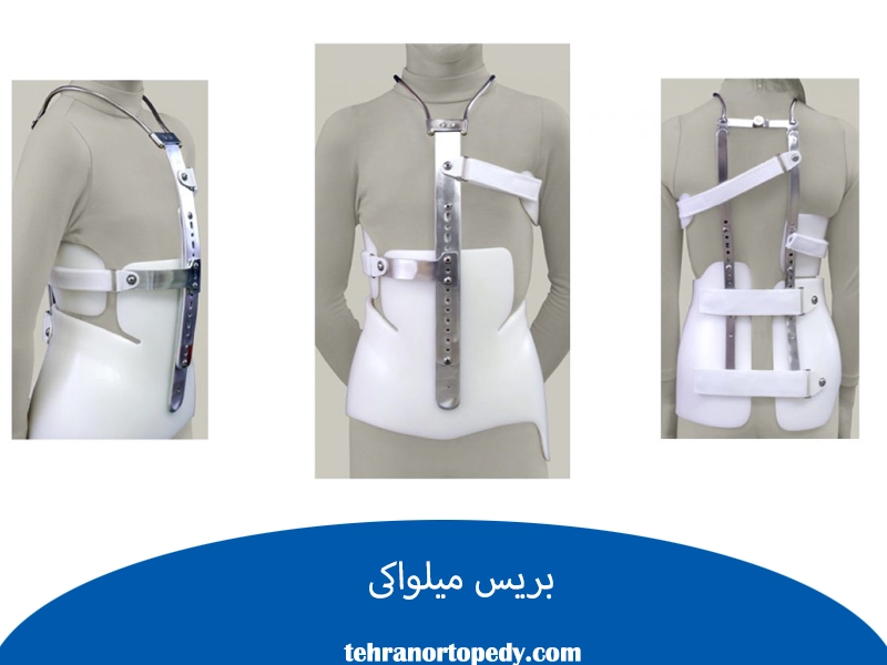 بریس میلواکی