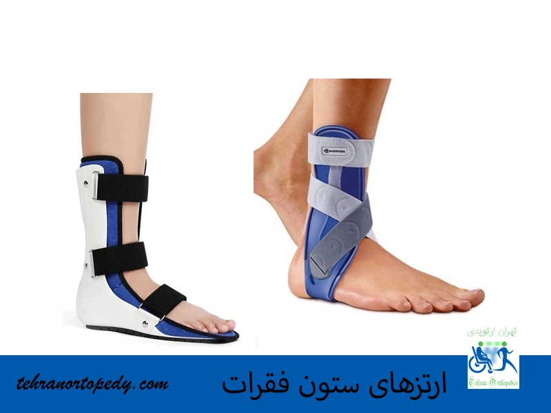 ارتزهای اندام تحتانی