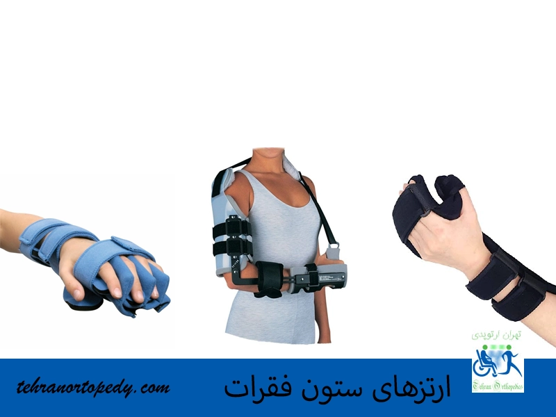 ارتزهای اندام فوقانی