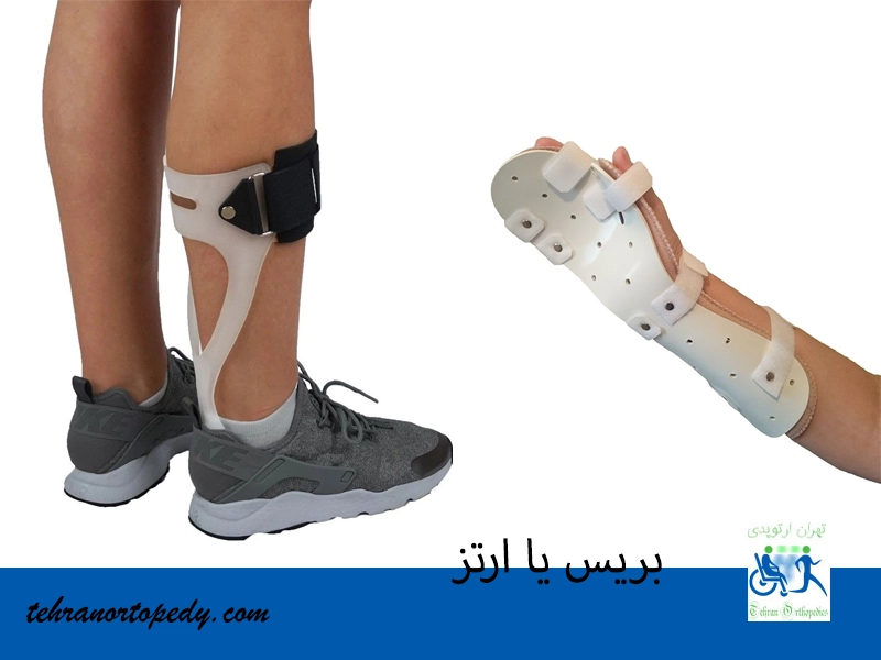 بریس یا ارتز