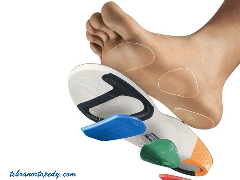 ساختار فنی کفش طبی