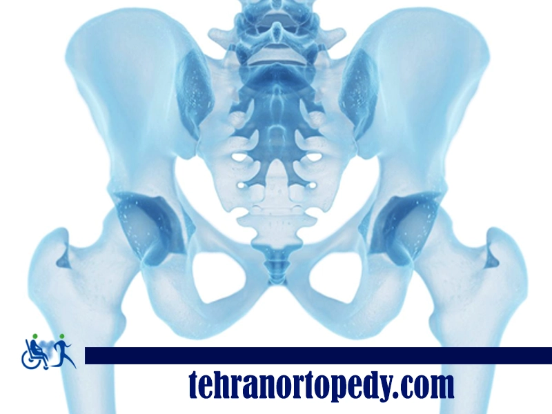 سیاه شدن استخوان لگن