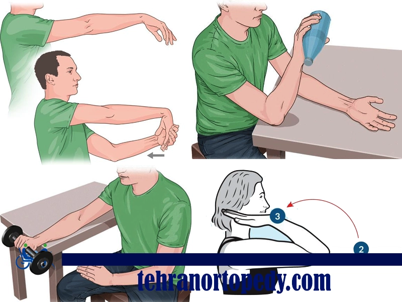 بریس یا آرنج بند